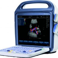 Portable Ultrasound Scanner