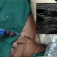 US Guided Procedures
