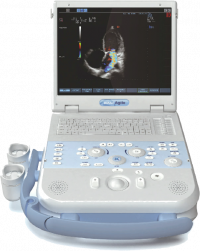 agile,scanner,ultrasound,kontron,esaote,medical,portable,referbished,service,repairs,p300