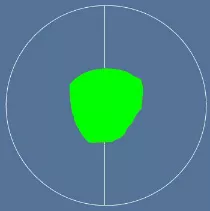 Bladder Located by correct Probe positioning