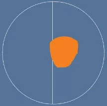 Bladder Locating Guide
