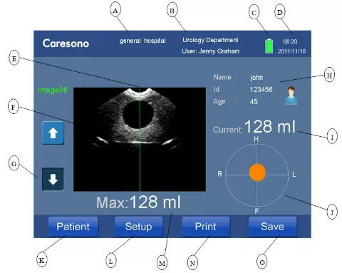 Bladder Scanner Screen information