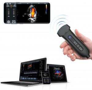 Q7 wifi ultrasound scanner