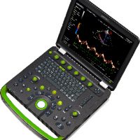 Portable Ultrasound Scanner