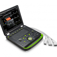 Ultrasound Scanners