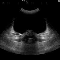 Ultrasound Scanners for Urology