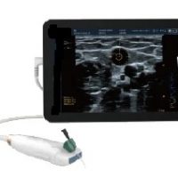 Vascular Colour Doppler