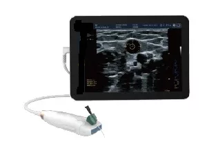 Vascular Colour Doppler