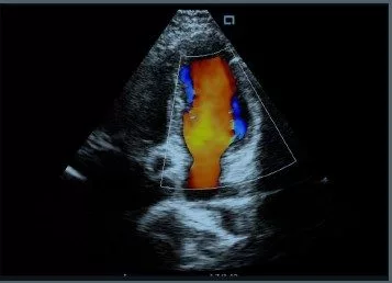 Vital signs and monitoring