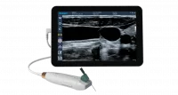 Ultrasound Needle
