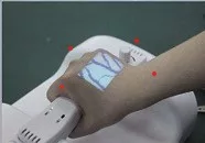 wrist veins